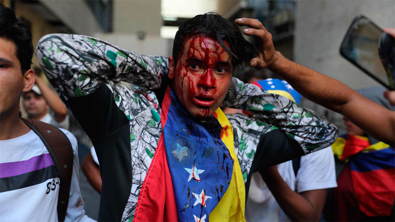 Resultado de imagen para venezuela muertos