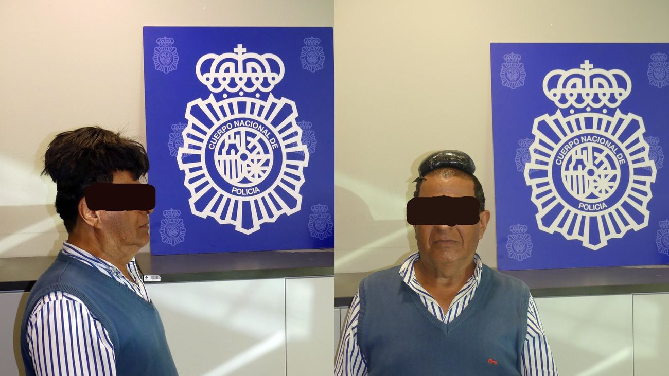 Detenido por transportar droga debajo de un peluquín