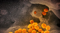 La supervivencia del coronavirus depende de humedad, temperatura y superficie, según un estudio