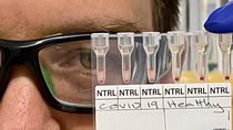 Madrid notifica tres nuevos brotes en la región con 23 casos de coronavirus