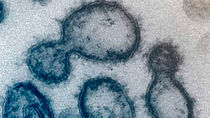 Obtienen los primeros genomas completos del coronavirus COVID-19 en España