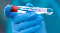 Sanidad aprueba los test antigénicos como herramienta rápida de diagnóstico y cribado del Covid-19
