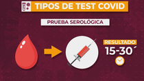Tipos de test que existen para detectar el coronavirus y su fiabilidad
